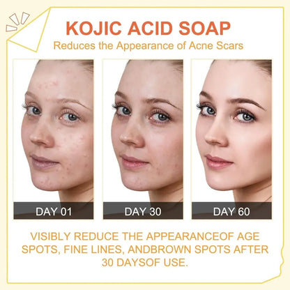 Kojic acid brightening soap – 200g