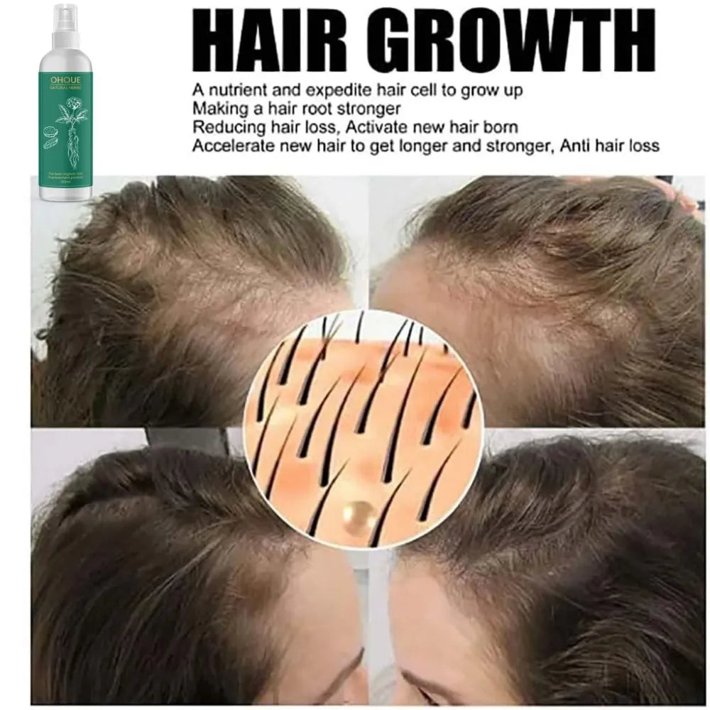 Ohoue natural herbs hair serum – 100ml