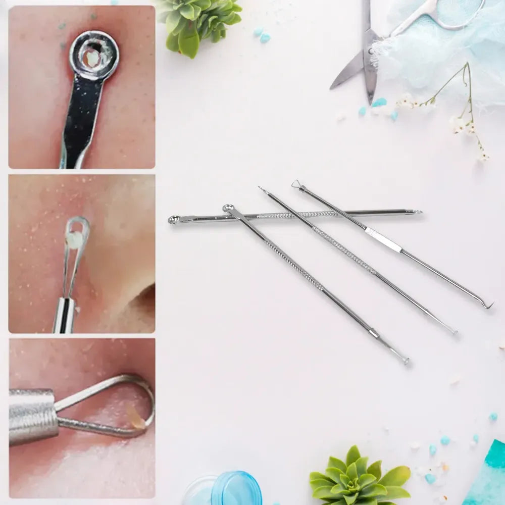 Professional blackhead remover tool - home improvement