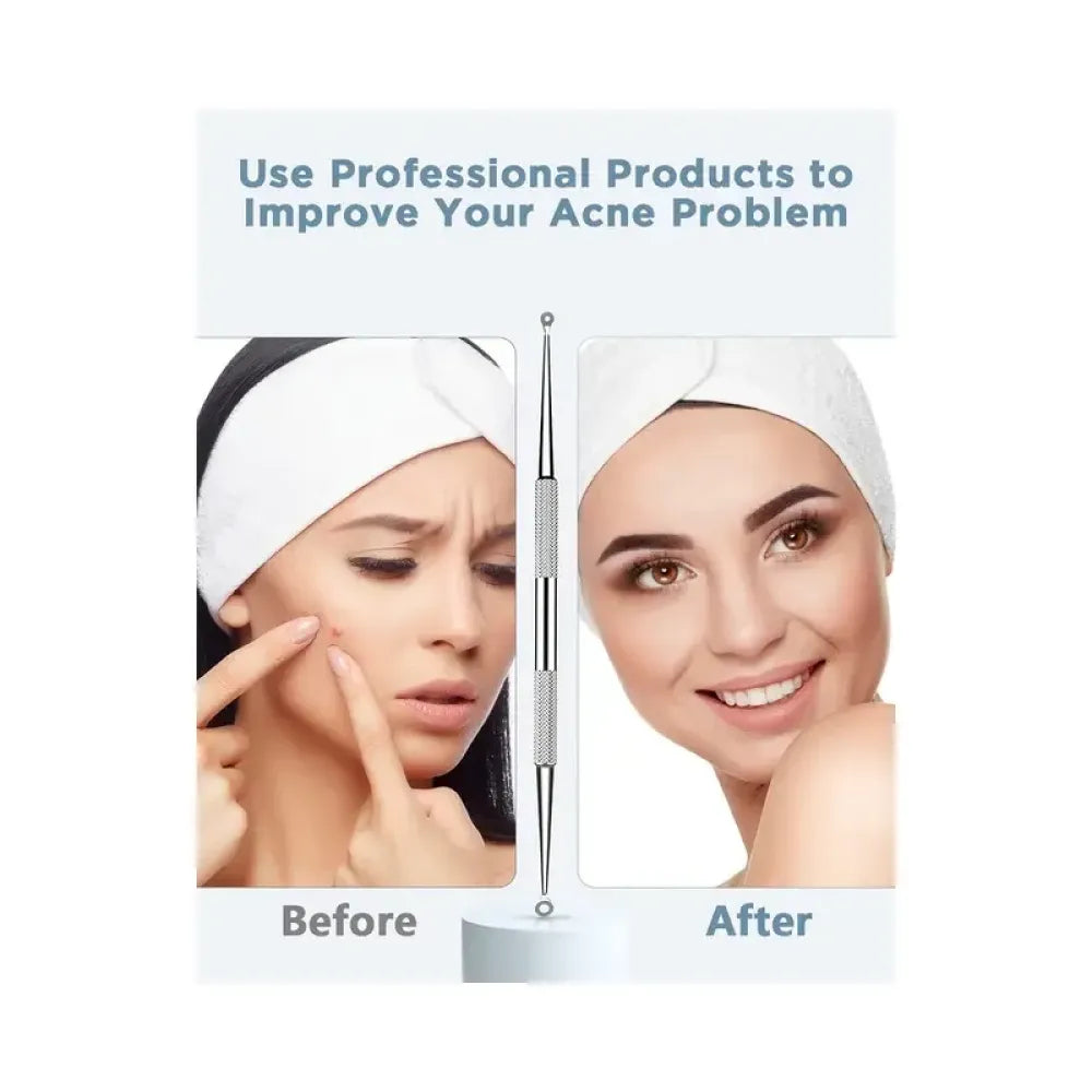 Professional blackhead remover tool - home improvement