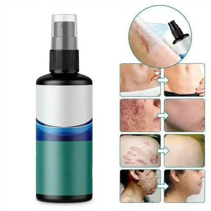 Scar removal silicone spray