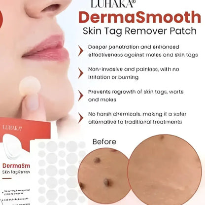 Skin tag remover patches