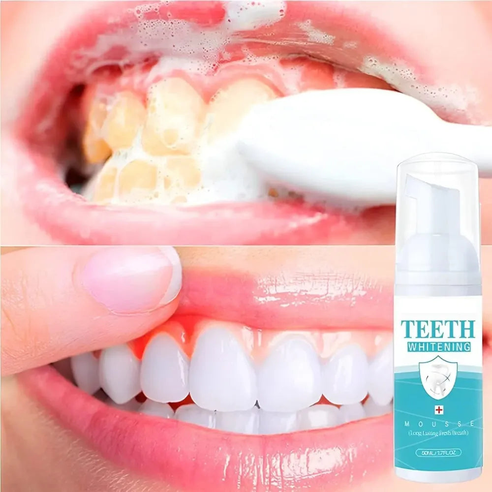 Teeth whitening foam 60ml