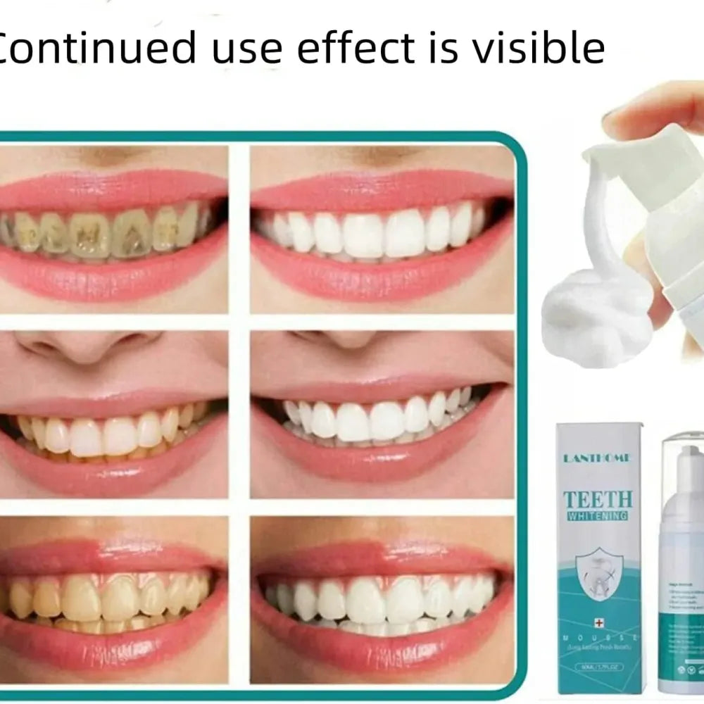 Teeth whitening foam 60ml