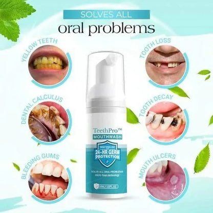 Teeth whitening foam 60ml (pack of 2)