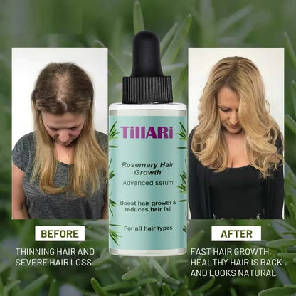 Tillari rosemary hair growth serum (pack of 2)