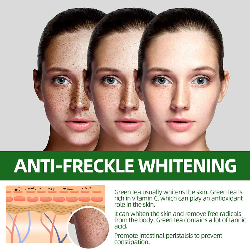 Anti-freckle green tea serum – 50ml (pack of 2)