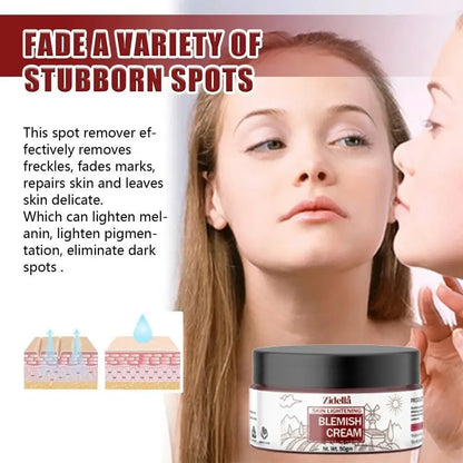 Zidella blemish cream 50g
