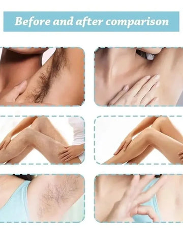 Zidella Hair Removal Spray 100ml